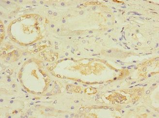 UBE4A Antibody