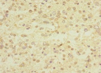 UBE4A Antibody