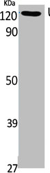 UBE4A Antibody