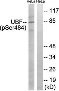 UBF (Phospho-Ser484) Antibody