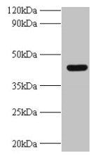 UBE2Q2 Antibody