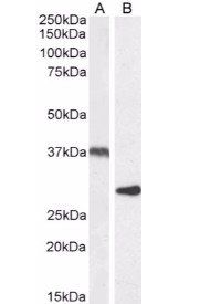 Uncoupling protein 2/UCP2 Antibody