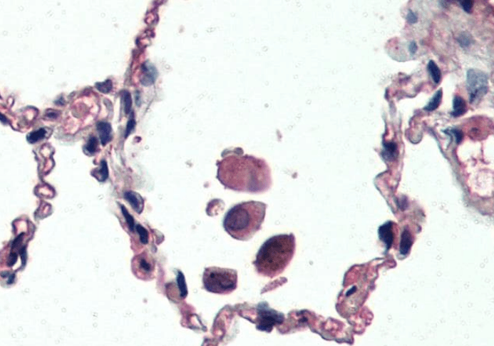 Uncoupling protein 2/UCP2 Antibody