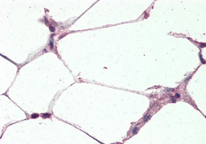 Uncoupling protein 2/UCP2 Antibody