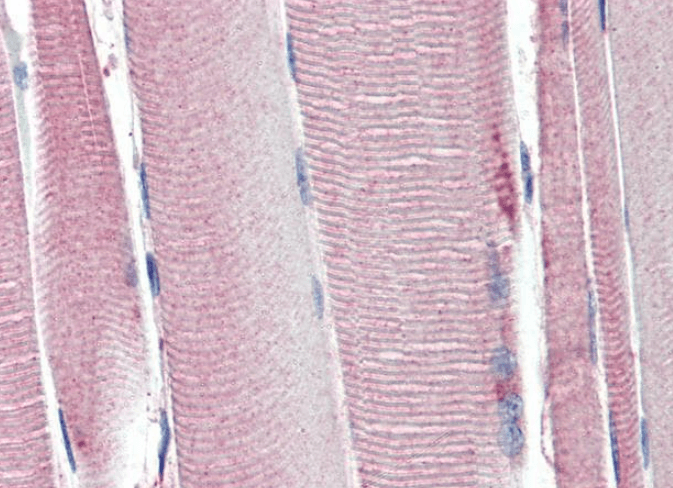 Uncoupling protein 2/UCP2 Antibody