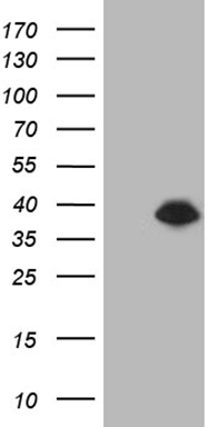 UEVLD Antibody