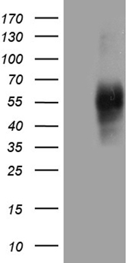 UEVLD Antibody