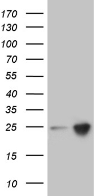 UEVLD Antibody