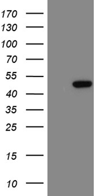 UEVLD Antibody