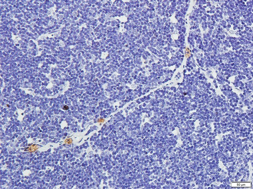 UHRF2 Rabbit Polyclonal Antibody