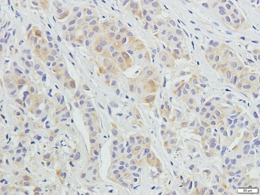 UHRF2 Rabbit Polyclonal Antibody