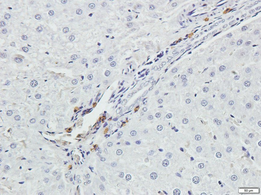 UHRF2 Rabbit Polyclonal Antibody