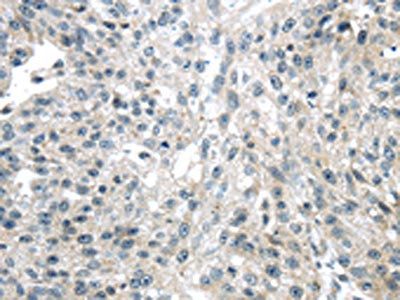 ULBP1 Antibody