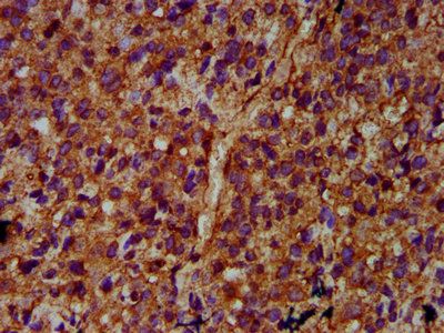 ULK2 Antibody