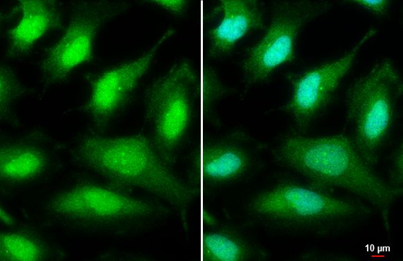 ULK2 Rabbit Polyclonal Antibody