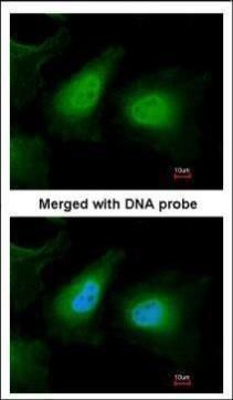 ULK2 Rabbit Polyclonal Antibody