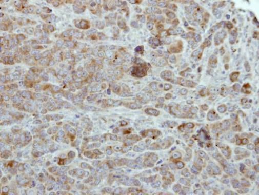 ULK2 Rabbit Polyclonal Antibody