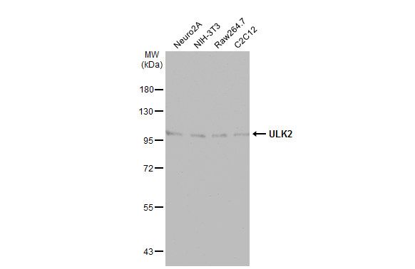 ULK2 Rabbit Polyclonal Antibody