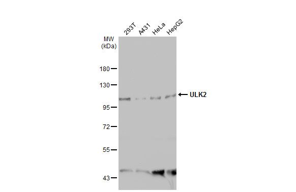 ULK2 Rabbit Polyclonal Antibody