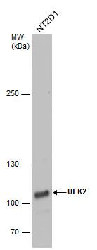 ULK2 Rabbit Polyclonal Antibody