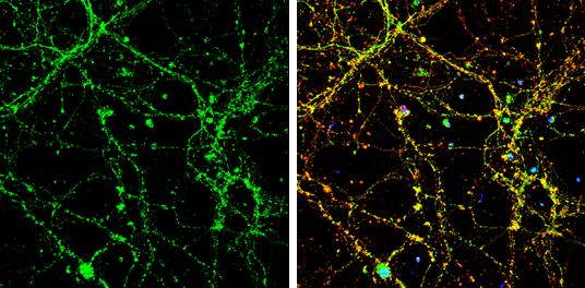UNC13B Rabbit Polyclonal Antibody
