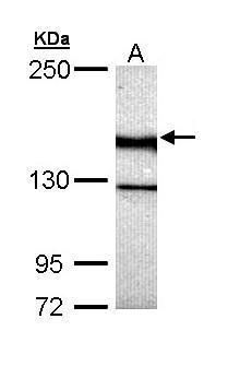 UNC13B Rabbit Polyclonal Antibody