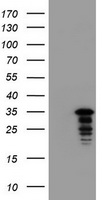 UPRT Antibody