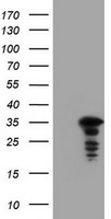 UPRT Antibody