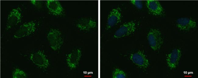 UQCRFS1 antibody [N1C3]