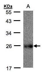 UQCRFS1 antibody [N1C3]