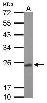 UQCRFS1 antibody [N1C3]