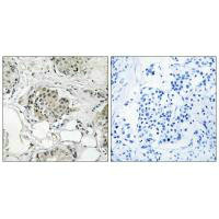 USP13 Antibody
