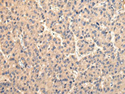 USP15 Antibody