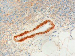 USP20/VDU2 Antibody