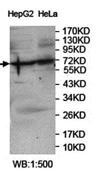 USP22 Rabbit Polyclonal Antibody