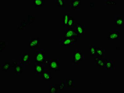USP22 Antibody