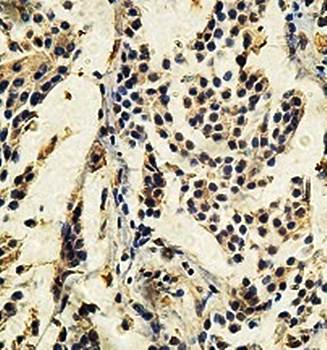 USP25 Rabbit Polyclonal Antibody