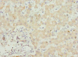 USP26 Antibody