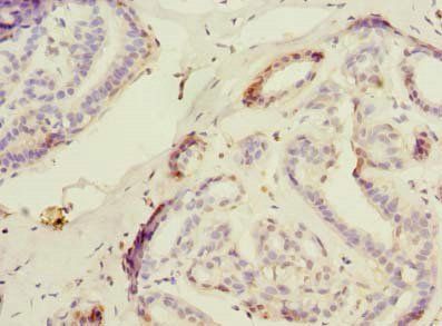USP30 Antibody