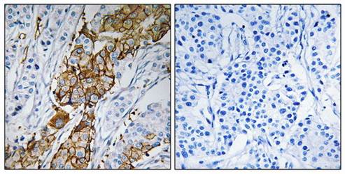 USP32 Antibody