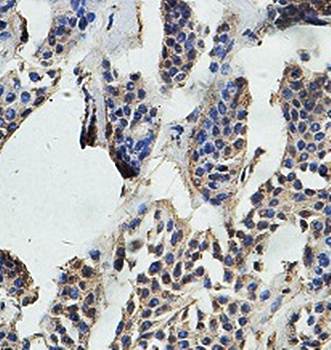 USP33 Rabbit Polyclonal Antibody