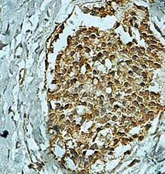 USP37 Rabbit Polyclonal Antibody