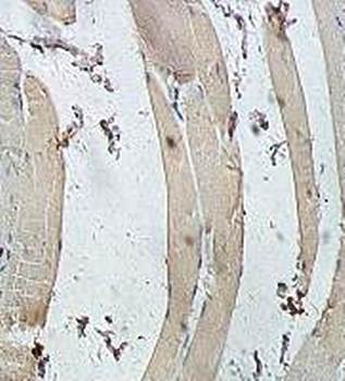 USP38 Rabbit Polyclonal Antibody