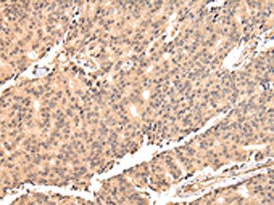 USP45 Antibody