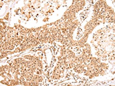 USP45 Antibody
