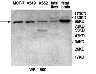 USP5 Rabbit Polyclonal Antibody
