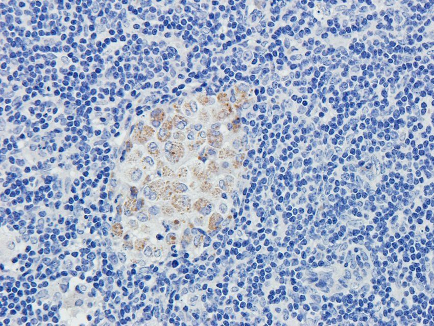 VAMP7 Rabbit Polyclonal Antibody