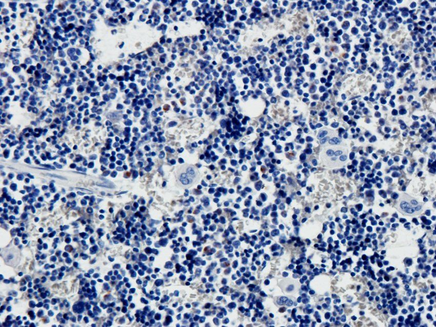 VAMP7 Rabbit Polyclonal Antibody