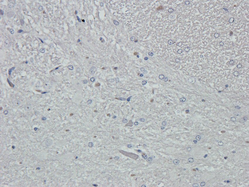 VAMP7 Rabbit Polyclonal Antibody