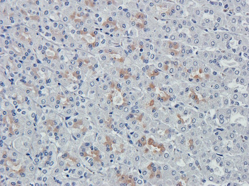 VAMP7 Rabbit Polyclonal Antibody